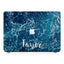 Macbook Premium Case - Ocean